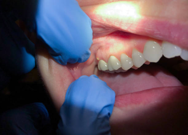 Best Teeth Whitening  in Midfield, AL